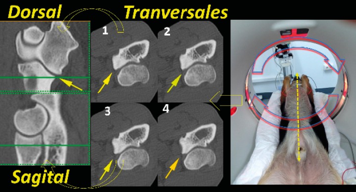 <p>TC realizada con el animal en decúbito supino y los codos extendidos. Realizamos estudios comparados de ambos codos y hombros. Al introducir el animal en el <em>gantry</em>, el tubo rota alrededor de los codos y produce imágenes en planos transversales. A partir del plano transversal, la imagen se reformatea en planos dorsal y sagital. La línea verde continua, de los planos dorsal y sagital, representa a qué nivel se han obtenido los cortes transversales, En este caso cada línea verde representa 4 imágenes consecutivas (de 0,6 mm de grosor) siempre en el orden que se marca (de 1 a 4). Las flechas amarillas indican la ACM. Aunque la TC se ha realizado de los dos codos, en este caso hemos seleccionado solamente el codo derecho.</p>