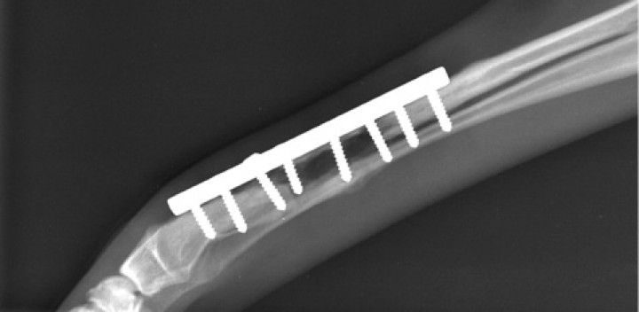 <p>Radiografía mediolateral que muestra la desmineralización y defecto óseo en la zona subyacente al implante secundarios a la osteomielitis, correspondiente al día de la primera consulta (día 48).</p>