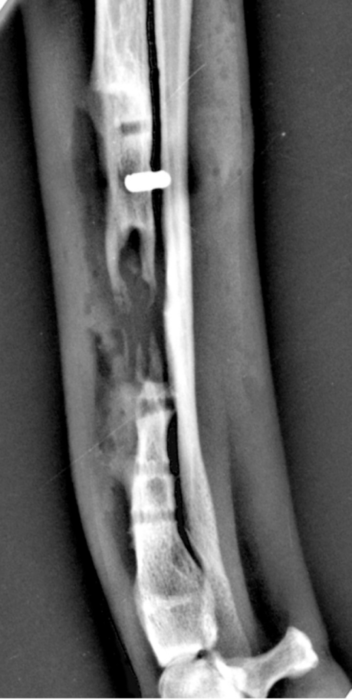 <p>Imagen radiológica intraoperatoria en proyección mediolateral durante la retirada del implante (día 146).</p>