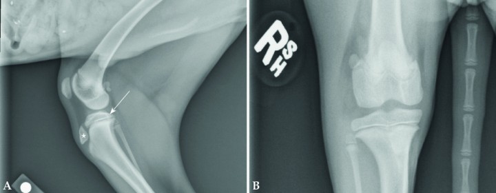 <p>A la hora de diagnosticar fracturas de la línea de crecimiento es fundamental conocer la anatomía normal de estos animales inmaduros durante su crecimiento. Quizás las líneas de crecimiento de la tibia proximal sean la que más dudas generan ante una posible fractura. Estas son las radiografías normales de un perro de 4,5 meses de edad en las que se pueden apreciar las líneas de crecimiento óseas. En la proyección mediolateral (Fig. 2A) la zona de crecimiento de la tibia proximal tiene varios centros de osificación, la tuberosidad tibial (asterisco) y la meseta tibial (flecha). También se observa la línea de crecimiento del fémur distal con su forma en “W”. En la proyección craneocaudal (Fig. 2B) son visibles la línea de crecimiento de la meseta tibial, peroné y fémur.</p>
