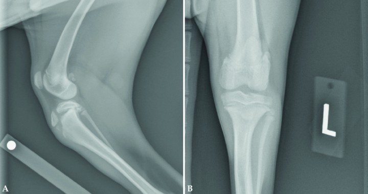 <p>Fractura a nivel de la línea de crecimiento de la tibia proximal en un cachorro de 4,5 meses de edad. En la proyección mediolateral (Fig. 4A) se puede observar que el fragmento proximal de la fractura lo componen la meseta tibial y la tuberosidad tibial. No existe línea de fractura entre la meseta tibial y la tuberosidad tibial. Nótese el desplazamiento caudal de la meseta tibial en relación al resto de la tibia. En la proyección craneocaudal (Fig. 4B) se observa un incremento de la opacidad de los tejidos blandos a nivel de la línea de crecimiento, aunque no existe desplazamiento de la fractura medio-lateralmente.</p>