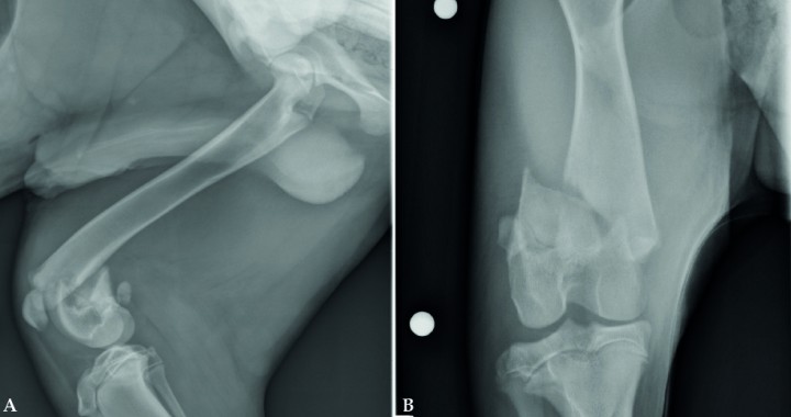<p>Cachorro de 5,5 meses con una fractura Salter-Harris de tipo II del fémur distal. Este tipo de fracturas suele conllevar un desplazamiento caudal del fémur distal (Fig. 5A) comprometiendo la posible extensión de la rodilla. En la proyección craneocaudal (Fig. 5B) se puede apreciar que la fractura discurre en gran parte por la metáfisis del fémur distal.</p>