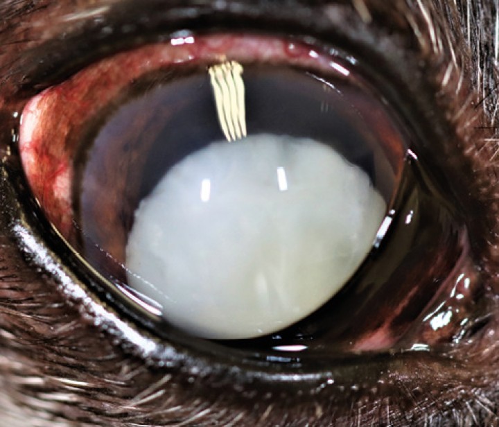 <p>Imagen de luxación anterior de cristalino en un perro con catarata hipermadura.</p>