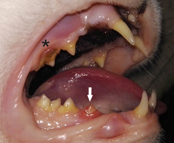 <p> Ausencia aparente de 106 (segundo premolar maxilar dere­cho) y 109 (primer molar maxilar derecho). Cálculo dental de índice 2 en 107 (asterisco). Gingivitis y sobrecrecimiento de la encía que cubre parcialmente el diente 407 compatible con RD (flecha).</p>
