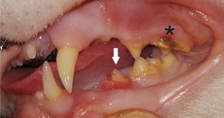 <p>Ausencia aparente de 206 (segundo premolar maxilar izquier­do) y 209 (primer molar maxilar izquierdo). Cálculo dental de índice 2 en 207 (asterisco). Gingivitis y sobrecrecimiento de la encía que cubre parcialmente el diente 307 compatible con RD (flecha).</p>