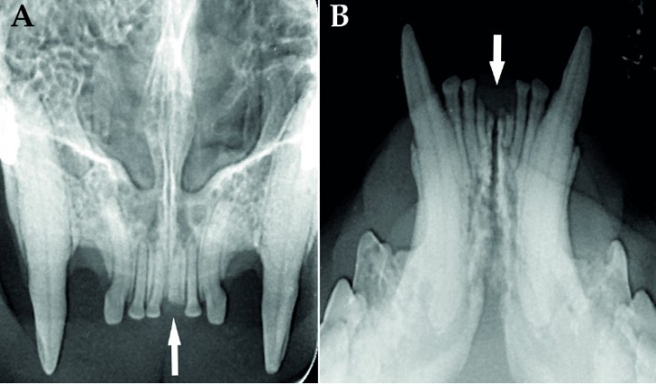 <p>(<strong>A</strong>) Radiografía dental oclusal de los incisivos y caninos maxilares donde se observa el resto radicular consecuencia de fractura dental en 201 (flecha). (<strong>B</strong>) Radiografía dental oclusal de los incisivos y caninos mandibulares donde se observan restos radiculares consecuencia de fracturas dentales en 301 y 401 (flechas).</p>