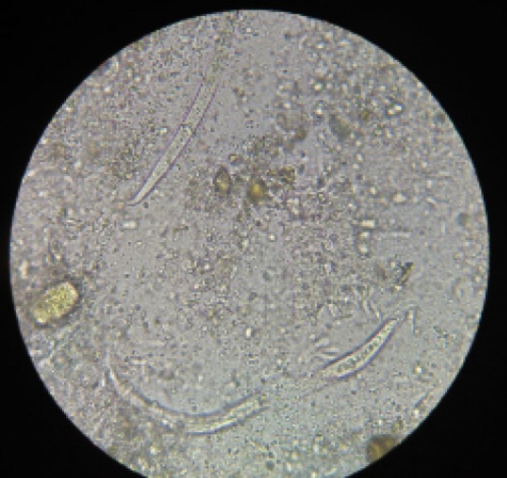 <p>Frotis fecal en el que se observan dos larvas de <em>Aelurostrongylus asbtrusus</em>. Aumentos totales x10.</p>