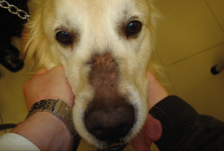 <p><strong>Alopecia canina recurrente en el puente nasal</strong>. Este cuadro clínico es poco frecuente y con la anamnesis detallada del caso podemos llegar a su diagnóstico tentativo. Se caracteriza por sus bordes irregulares y, a veces, hiperpigmentación; suele presentarse en épocas de días con menos horas de luz. Una vez descartados sus diferenciales más probables como la dermatofitosis o alguna enfermedad autoinmune, que suelen ser mucho más inflamatorias, podemos inducir que se trata de una alopecia cíclica o recurrente que puede repetirse cada año y presentarse también más frecuentemente en los flancos y, a veces, en las bases de las orejas o en el inicio de la cola. Su diagnóstico definitivo se puede obtener por medio de una estudio histopatológico. La melatonina puede ser interesante como recurso terapéutico para acelerar una recuperación que suele ser espontánea.</p>
