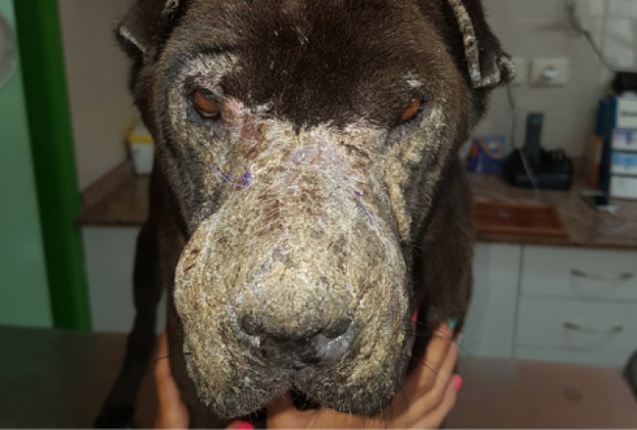 <p><strong>Pénfigo foliáceo canino facial</strong>. La cara suele ser una región del cuerpo frecuentemente afectada por esta enfermedad autoinmune. La reacción pustular y costrosa en el puente nasal, alrededor de los ojos, en los bordes de las orejas y las típicas costras en la cara medial del pabellón auricular hacen de este cuadro clínico una presentación que nos hace sospechar con bastante fundamento de esta enfermedad. Sus diagnósticos diferenciales más probables serían la dermatofitosis, que no suele ser tan costrosa, la sarna sarcóptica y el lupus cutáneo, que suele afectar más la trufa y ser más ulcerativo y menos costroso. El diagnóstico gracias a su presentación clínica y a la presencia de acantocitos en las citologías de pústulas o bajo costras puede ser bastante sencillo, aunque siempre debe confirmarse con una biopsia. Su manejo terapéutico suele inducirse inmunosuprimiendo con corticoesteroides para luego buscar una dosis de mantenimiento lo más inocua posible o el uso de otros fármacos alternativos.</p>