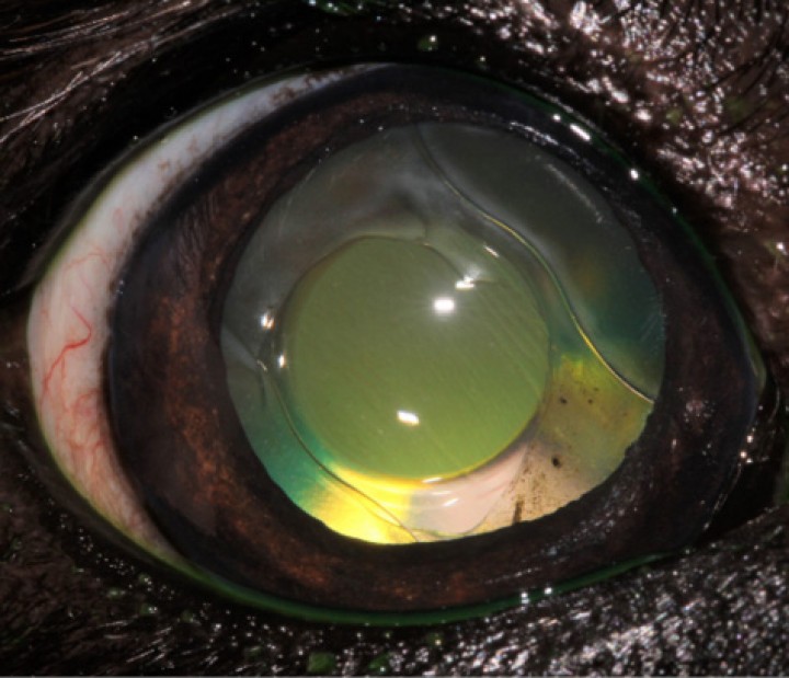 <p>Imagen postquirúrgica de cirugía de facoemulsificación con lente intraocular.</p>