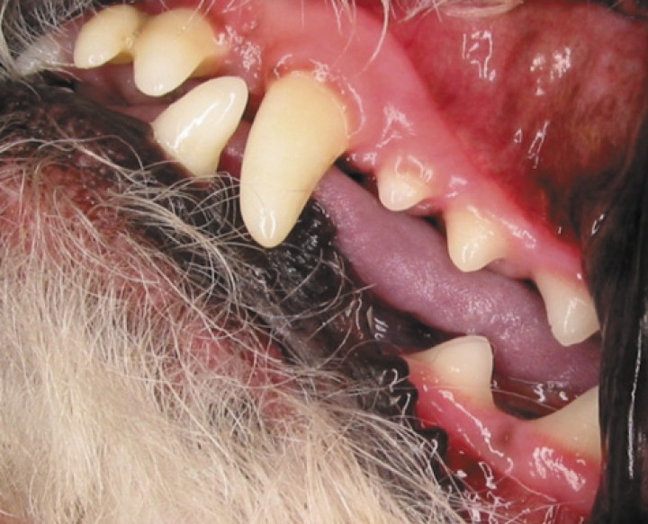 <p>Boca sana con ausencia de enfermedad periodontal.</p>