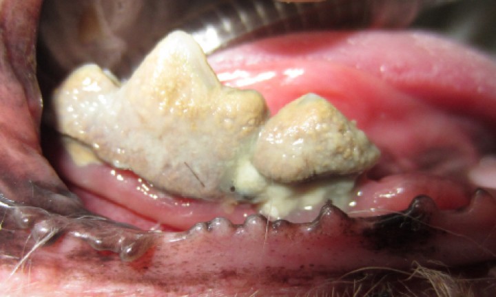 <p>Enfermedad periodontal grave con bolsas periodontales y recesión gingival.</p>