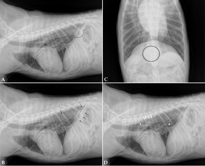 <p style=\"text-align:justify\">Mismas imágenes que Figura 1. (<strong>A</strong>, <strong>B</strong>) Se observa dilatación de la aorta intratorácica caudal (línea negra discontinua) con focos de mineralización distrófica en su pared entre la T8-T12 (flechas negras). (<strong>C</strong>) Ventral a T11 se evidencia una estructura circunferencial con mineralización de su pared (área delimitada en negro). (<strong>D</strong>) El esófago intratorácico presenta discreta dilatación con aire en su luz (asterisco blanco). Las flechas blancas señalan la espondilosis más marcada en T4, T5, T6.</p>