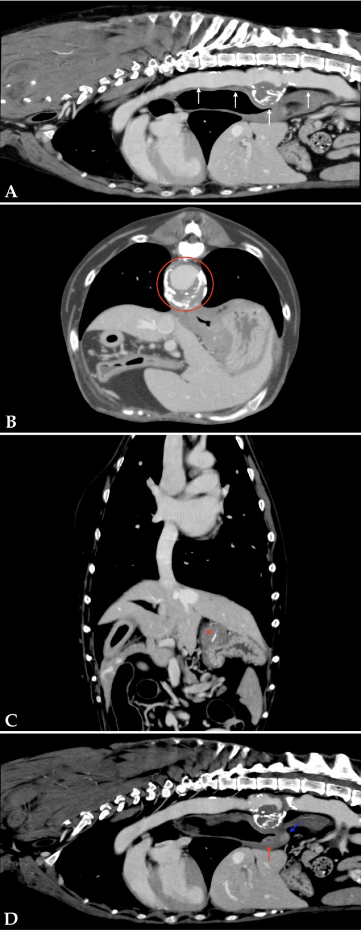 <p style=\"text-align:justify\">Imágenes de TC de tórax en ventana tejido blando postcontraste. (<strong>A</strong>, <strong>D</strong>) Plano sagital. (<strong>B</strong>) Plano transversal. (<strong>C</strong>) Plano dorsal. Se observa dilatación de la aorta caudal y abdominal (flechas blancas) y dilatación circunferencial con halo hipoatenuante a nivel de T11 (área delimitada en rojo). Masa intramural craneomedial al fundus gástrico con mineralización distrófica (asterisco rojo). Lesión nodular localizada caudal y medial al cardias (flecha azul) y otra en la pared medial del esófago, craneal al hiato esofágico (flecha roja).</p>