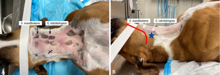 <p><strong>Cabeza y cuello</strong>. Posicionamiento y preparación del paciente para una linfadenectomía de ganglios linfáticos mandibulares y retrofaríngeos mediales. Dependiendo de la raza, puede colocarse un soporte en la zona cervical dorsal para elevar el área quirúrgica. En la Figura <strong>1A</strong>, la localización anatómica de los ganglios linfáticos está marcada por una cruz; los <strong>ganglios mandibulares</strong> (dorsal y ventral) son palpables y se encuentran caudalmente al ángulo de la mandíbula, y dorsal y ventralmente a la vena linguofacial. Los <strong>ganglios retrofaríngeos</strong> son los ganglios más grandes de la cabeza y cuello. Se encuentran ventrales a las alas del atlas, en un triángulo formado por los músculos digástrico (craneal) y <em>longus colli</em> (dorsal) y la faringe/laringe (ventromedial). En la Figura <strong>1B</strong>, se muestran las referencias anatómicas, el ángulo caudal de la mandíbula (línea roja) y la glándula salivar mandibular (estrella), para la localización de los ganglios mandibulares y de los ganglios retrofaríngeos.</p>