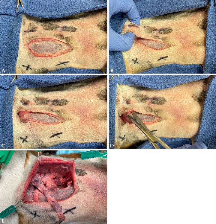 <p><strong>Ganglios mandibulares (dorsal y ventral)</strong>. Se presenta el abordaje ventral en la línea media para la linfadenectomía de los ganglios mandibulares y retrofaríngeos mediales, bilateralmente (Fig. <strong>2A</strong>). Se realiza una incisión a través de la piel y el músculo platisma en la línea media ventral, desde el tercio caudal de la mandíbula hasta el nivel de la laringe. El ganglio linfático mandibular se palpa en la extensión caudal del cuerpo mandibular (rama horizontal) (Fig. <strong>2B</strong>) y se aísla mediante disección roma con la ayuda de una sutura de tracción a través del cuerpo del ganglio (Figs. <strong>2C</strong> y <strong>D</strong>). Esta técnica ayuda a evitar excesiva disección periganglionar y subsecuente seroma o hematoma. Normalmente se pueden encontrar de dos (ventral y dorsal) a tres ganglios mandibulares (Fig. <strong>2E</strong>), por lo que se recomienda palpar la zona después de la linfadenectomía para asegurarse de que no hay tejido ganglionar residual.</p>