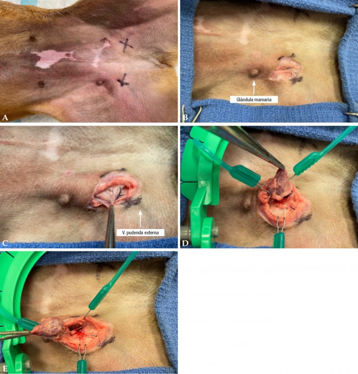 <p><strong>Ganglios inguinales</strong>. Los ganglios inguinales superficiales, también llamados ganglios escrotales en machos o ganglios mamarios en hembras, se encuentran dentro de la grasa inguinal entre la pared abdominal y la superficie medial del muslo (Fig. <strong>5A</strong>). En machos, los ganglios inguinales se encuentran entre el borde dorso-lateral del pene, craneal a la túnica vaginal a nivel del bulbo del glande. En las hembras, los ganglios inguinales se encuentran profundos y caudales a la última glándula mamaria (Fig. <strong>5B</strong>). Los vasos pudendos externos se pueden visualizar transcutáneamente y se encuentran laterales al ganglio (único, Fig. <strong>5C</strong>) o entre los ganglios inguinales craneal y caudal (múltiples). Una vez localizado el ganglio linfático inguinal, se disecciona la grasa perinodular (Fig. <strong>5D</strong>) hasta encontrar y cauterizar/ligar la vascularización y el conducto linfático del ganglio (Fig. <strong>5E</strong>).</p>