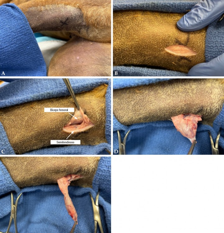 <p><strong>Ganglios poplíteos</strong>. Los ganglios poplíteos son palpables y residen en la grasa entre el borde medial del bíceps femoral y el borde lateral del músculo semitendinoso, justo caudal a la rodilla (Fig. <strong>6A</strong>). Para su extirpación, se hace una incisión cutánea y subcutánea justo encima del ganglio, paralela al eje sagital del miembro pélvico (Fig. <strong>6B</strong>). Combinando la palpación digital y la disección roma entre los músculos bíceps femoral y semitendinoso (Fig. <strong>6C</strong>) se empuja el ganglio hacia la superficie y se coloca una sutura de tracción a través del ganglio o se tracciona directamente con unas pinzas atraumáticas (Fig. <strong>6D</strong>). Esta sutura facilitará la disección roma mínima alrededor del ganglio (Fig. <strong>6E</strong>).</p>