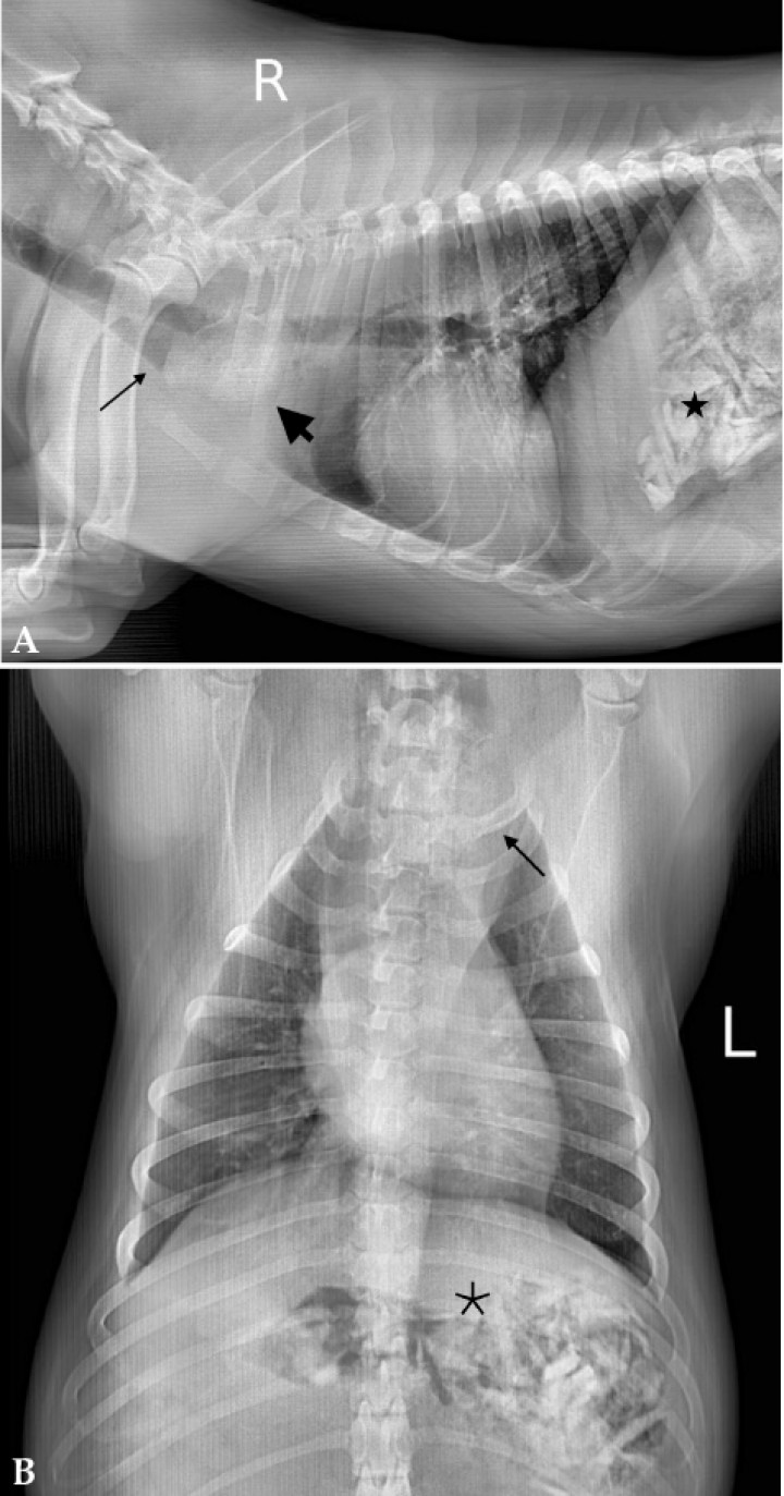 <p>Misma imagen que la Figura 1. (<strong>A</strong>) Radiografía de la cavidad torácica. A nivel de la entrada torácica, se observa una zona con aumento de la opacidad, con densidad hueso (flecha gruesa), el esófago craneal a esta zona está dilatado con acúmulo de gas (flecha fina). En abdomen craneal, se observan en estómago estructuras de distinta forma y tamaño con radiopacidad hueso (asterisco). (<strong>B</strong>) Aumento de la densidad radiográfica en la entrada torácica con aumento de las dimensiones del mediastino craneal (flecha). El estómago contiene numerosas estructuras con densidad hueso (asterisco).</p>
