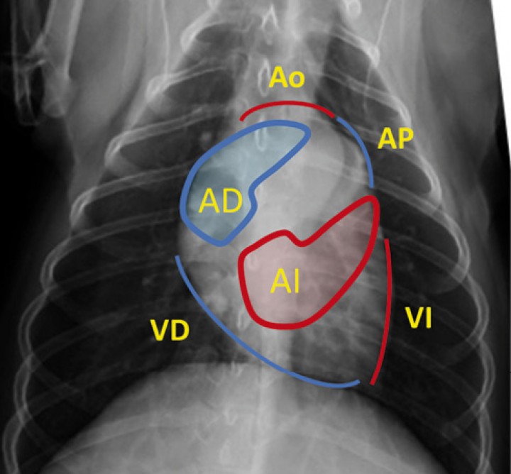 <p>Proyección dorsoventral con diagrama de la localización anatómica de las distintas cámaras y grandes vasos. En color azul se representa corazón derecho y en color rojo corazón izquierdo. Ao: aorta. AP: arteria pulmonar. AD: atrio derecho. AI: atrio izquierdo. VD: ventrículo derecho. VI: ventrículo izquierdo.</p>