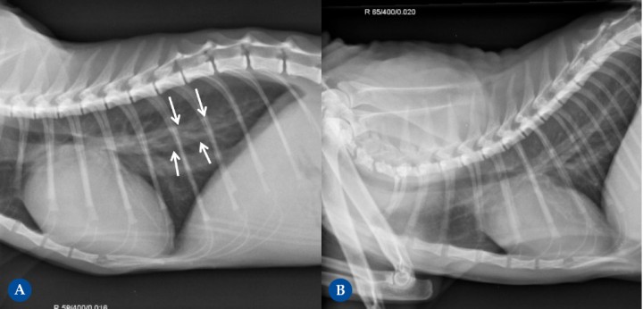 <p>Gata Sphynx, hembra castrada, 1 año edad. El motivo de la consulta es marcada anemia hemolítica, con un hematocrito del 10%. (<strong>A</strong>) Proyección lateral derecha. En el estudio radiográfico en el momento del diagnóstico se detecta una marcada cardiomegalia, una silueta cardíaca que ocupa 4 EIC, con una forma marcadamente redondeada, y con una elevación de la tráquea. Los vasos pulmonares también se observan moderadamente aumentados de grosor (flechas blancas). Se inicia el tratamiento y se realiza ecocardiografía a los 10 días, donde no se observa ninguna alteración cardíaca congénita. La principal sospecha es de una cardiomegalia compensatoria secundaria a la anémica crónica. (<strong>B</strong>) Proyección lateral derecha. En la radiografía de control se aprecia una reducción significativa de la cardiomegalia previamente observada.</p>
