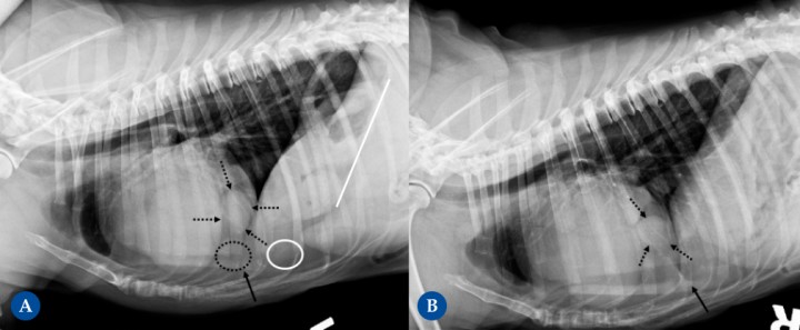 <p>(<strong>A</strong>) Proyección lateral izquierda. (<strong>B</strong>) Proyección lateral derecha. Cruce de Labrador, hembra castrada, 9 años. Hernia peritoneo-pericárdico diafragmática conteniendo parte del hígado, vesícula biliar y grasa falciforme. Hallazgo incidental sin sintomatología asociada, se detecta como parte de protocolo diagnóstico neurológico por posibles convulsiones. Aspecto globoso de la silueta cardíaca que presenta un aumento moderado del tamaño, unos márgenes redondeados en las diferentes proyecciones ortogonales y un desplazamiento dorsal de la tráquea. Se observa signo de silueta entre el margen caudoventral de la silueta cardíaca y el diafragma (flecha negra). La silueta cardíaca presenta una opacidad mixta tejido blando y grasa, con la presencia de una área aproximadamente nodular de opacidad tejido en el margen caudal, ventral a la vena cava caudal en las proyecciones laterales (6ª espacio intercostal) (flechas negras punteadas). Además, se detecta presencia de contenido de opacidad grasa (círculo punteado). En el abdomen craneal incluido, se detecta una disminución evidente del tamaño de la silueta hepática (signo del abdomen vacío) [círculo blanco], sin visualizarse el aspecto ventral de los lóbulos hepáticos y con un desplazamiento craneodorsal marcado del eje gástrico (región pilórica) (la línea blanca representa el eje gástrico desplazado; debería ser paralelo a las costillas, perpendicular a la columna vertebral).</p>