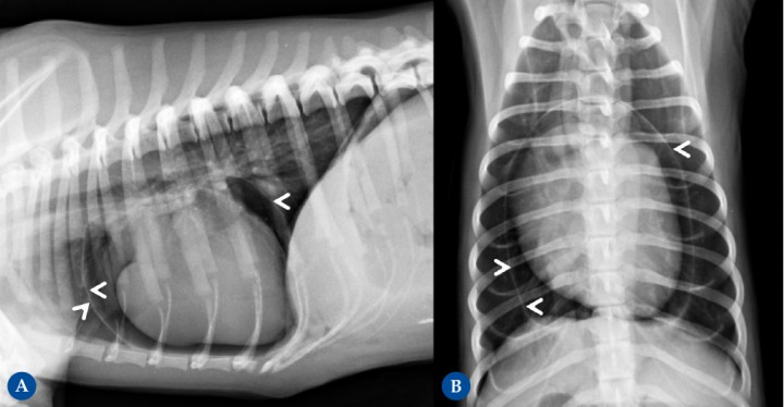<p>(<strong>A</strong>) Proyección lateral derecha. (<strong>B</strong>) Proyección ventrodorsal. Conviene recordar que en radiografía se valora el conjunto de la silueta cardíaca, que incluye el miocardio, pericardio y líquido pericárdico. Paciente con neumopericardio iatrogénico tras resolución quirúrgica de una hernia peritoneo-pericárdico diafragmática. Se identifica una fina línea de opacidad tejido blando (cabezas de flecha) creando una bolsa alrededor del corazón en ambas proyecciones radiográficas. Entre esta línea y el corazón se identifica un contenido de opacidad gas, lo que permite diferenciar con mayor claridad las cámaras cardíacas. En condiciones fisiológicas, en el espacio pericárdico se localiza una mínima cantidad de líquido, todo ello de opacidad tejido blando, por lo que no permite diferenciar los distintos componentes y por eso se determina como silueta cardíaca.</p>
