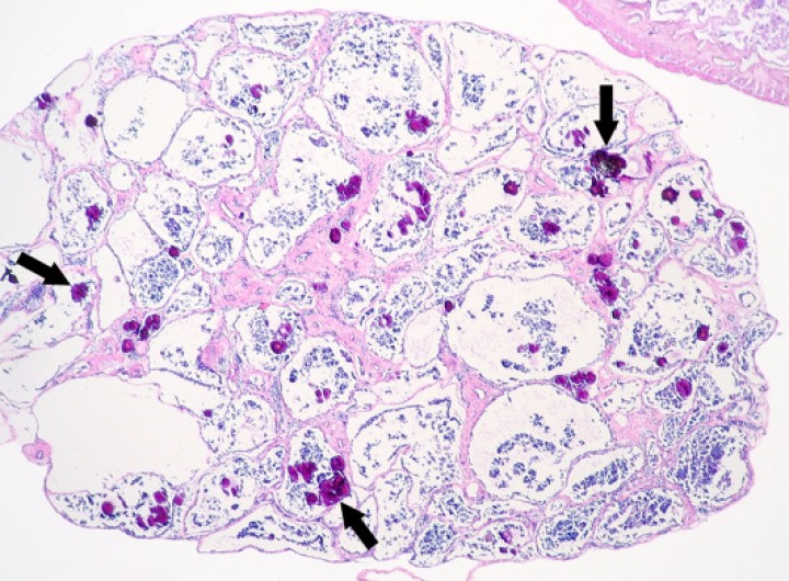 <p>Testículo; rana tomate (<em>Dyscophus guineti</em>). Numerosos túbulos seminíferos contienen depósitos de mineral (flechas). Hematoxilina-eosina, x44.</p>