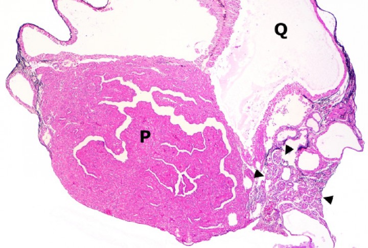 <p>Riñón; sapillo balear (<em>Alytes muletensis</em>). La sección de riñón del sapillo en la Figura 11 está casi completamente reemplazada por un adenoma con zonas papilares densas (P) y zonas quísticas (Q), que comprime el tejido renal no neoplásico restante (cabezas de flecha). Hematoxilina-eosina, x48.</p>