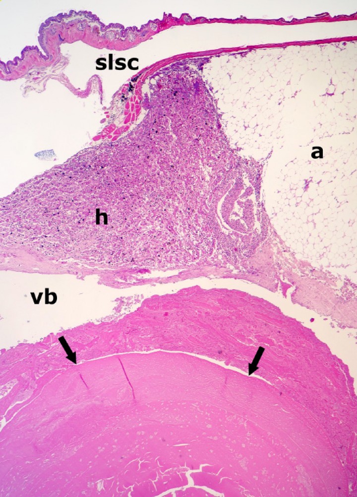 <p>Sapillo balear (<em>Alytes muletensis</em>). Se observa un colelito (cabezas de flecha) rodeado por secreción biliar condensada en la luz de la vesícula biliar (vb), la cual está distendida. El tejido adiposo (a) es marcadamente excesivo. slsc: seno linfático subcutáneo, h: hígado. Hematoxilina-eosina, x48.</p>