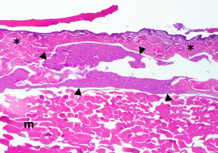 <p>Extremidad posterior; sapillo balear (<em>Alytes muletensis</em>). El seno linfático subcutáneo (delimitado con cabezas de flecha) está dilatado por abundante secreción biliar (con bacterias), lo cual se acompaña de necrosis de la dermis (asteriscos) y del músculo subyacente (m); con frecuencia, las fibras musculares necróticas están fragmentadas. Hematoxilina-eosina, x48.</p>