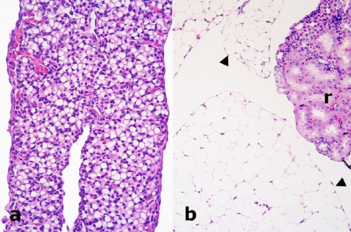 <p>Tejido adiposo; (a) rana dardo verdinegra (Dendrobates auratus), (b) sapillo de vientre de fuego oriental (<em>Bombina orientalis</em>). Se observa atrofia prominente de los adipocitos (a) en comparación con un tejido adiposo no atrófico (cabezas de flecha) (b). r: riñón. Hematoxilina-eosina, x220.</p>
