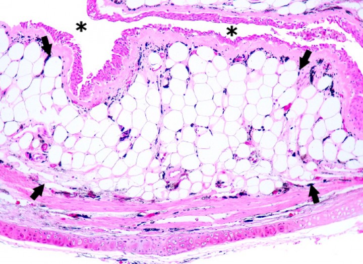 <p>Rana flecha azul (<em>Dendrobates azureus</em>), paciente de la izquierda de la Figura 19. La mucosa del esófago está engrosada debido a la presencia de abundantes adipocitos bien diferenciados e hipertróficos (flechas), que causa una reducción en el diámetro de la luz (asteriscos). Hematoxilina-eosina, x120.</p>