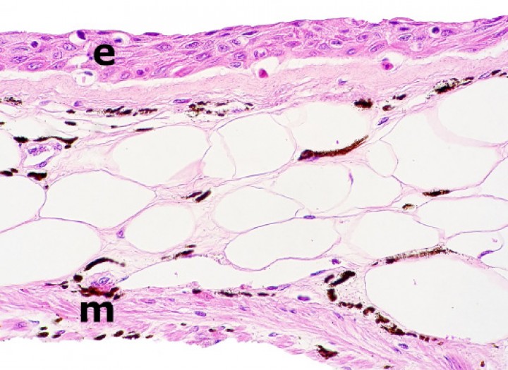 <p>Rana flecha azul (<em>Dendrobates azureus</em>). El epitelio (e) que reviste la mucosa del esófago es estratificado escamoso (es decir, ha sufrido metaplasia escamosa, ya que de forma normal es un epitelio simple ciliado). m: capas musculares. Hematoxilina-eosina, x480.</p>
