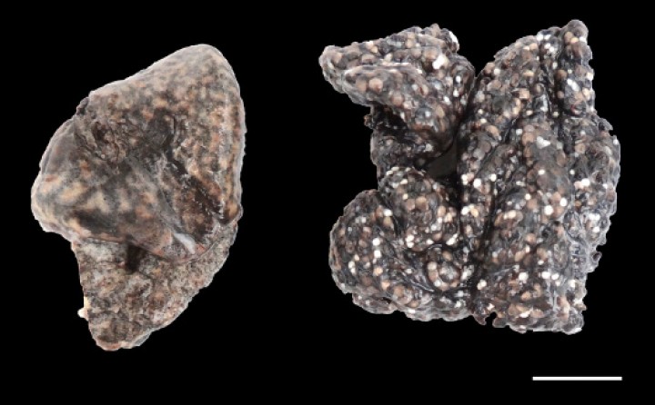 <p>Hígado y ovario; rana toro africana (<em>Pyxicephalus adspersus</em>). Tanto el hígado (izquierda) como el ovario (derecha) muestran melanización intensa. Algunos folículos ováricos son blancos (no melanizados). Barra: 1 cm.</p>