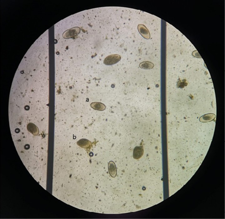 <p>Huevo de oxiúrido (a) y quiste de <em>Nyctotherus</em> (b).</p>