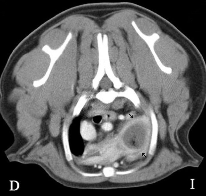 <p>Imagen de tomografía computarizada (TC) del tórax en plano transversal en ventana de tejido blando tras la administración del contraste. Se visualiza en la zona del lóbulo craneal izquierdo un realce en anillo (flechas negras) con una zona central sin realce.</p>