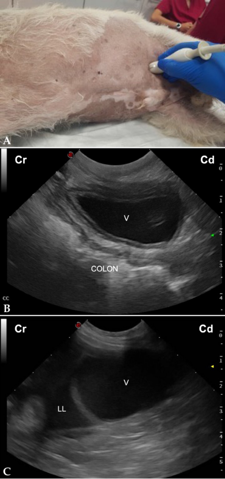 <p>(<strong>A</strong>) Posicionamiento de la sonda de ecografía para obtener la vista caudal. (<strong>B</strong>) Imagen ecográfica del área cistocólica (CC) de un perro sano, en la que se observa la vejiga (V) y el colon en corte longitudinal. Cr: craneal; Cd: caudal. (<strong>C</strong>) Imagen ecográfica del área cistocólica (CC) de un perro con hemoabdomen, en la que se observa la presencia de líquido libre anecogénico (LL) cranealmente a la vejiga (V). Cr: craneal; Cd: caudal.</p>