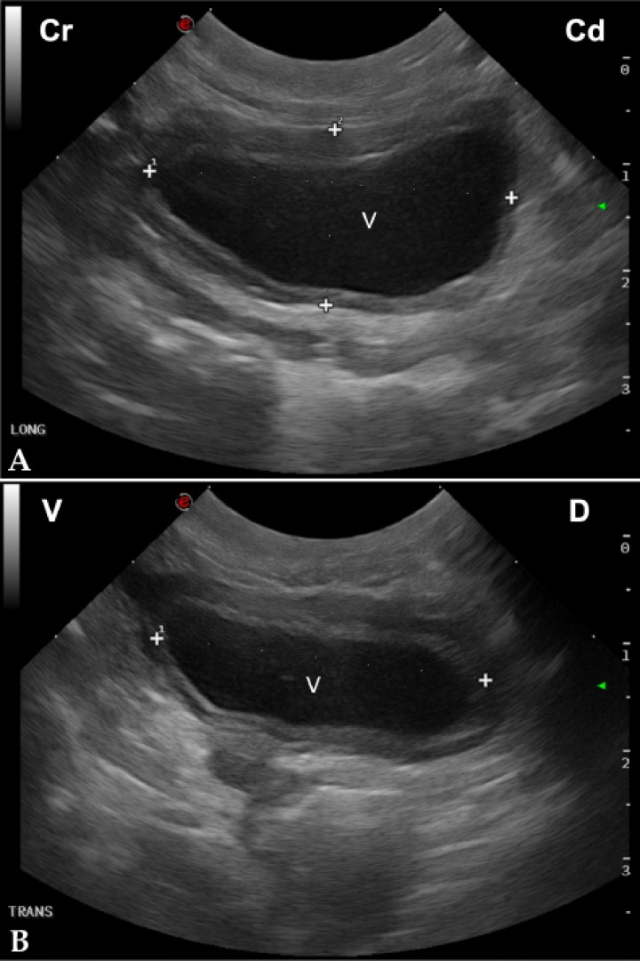 <p>(<strong>A</strong>) Imagen longitudinal de la vejiga. La distancia entre los calipers marcados con un 1 mide la longitud de la vejiga (V), mientras que los marcados con un 2 muestran la altura de la misma. Cr: craneal; Cd: caudal. (<strong>B</strong>) Imagen transversal de la vejiga. La distancia entre ambos calipers mide el ancho de la vejiga (V). V: ventral; D: dorsal.</p>