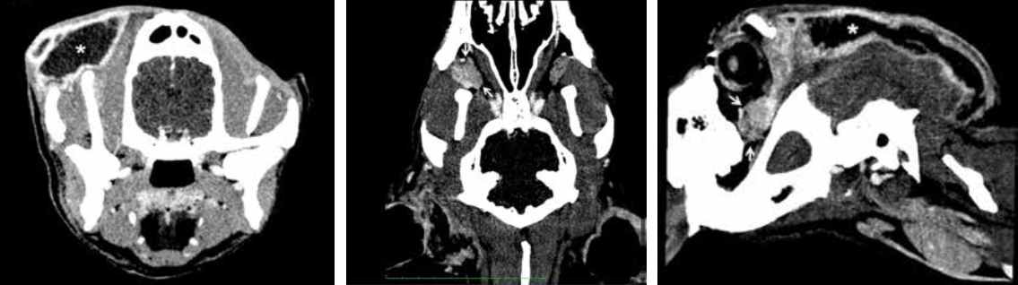 Imagen de tomografía computarizada postcontraste el día de la visita (A. Axial; B. Dorsal; C. Parasagital) en la que se observa un aumento de tamaño de la glándula cigomática derecha (flecha) con captación de contraste marcada y heterogénea que se comunica con un acúmulo de material hipodenso subcutáneo bien encapsulado que se extiende desde la región frontal hasta la occipital (*). Ancho de ventana 142 UH. Centro de ventana 95 UH.