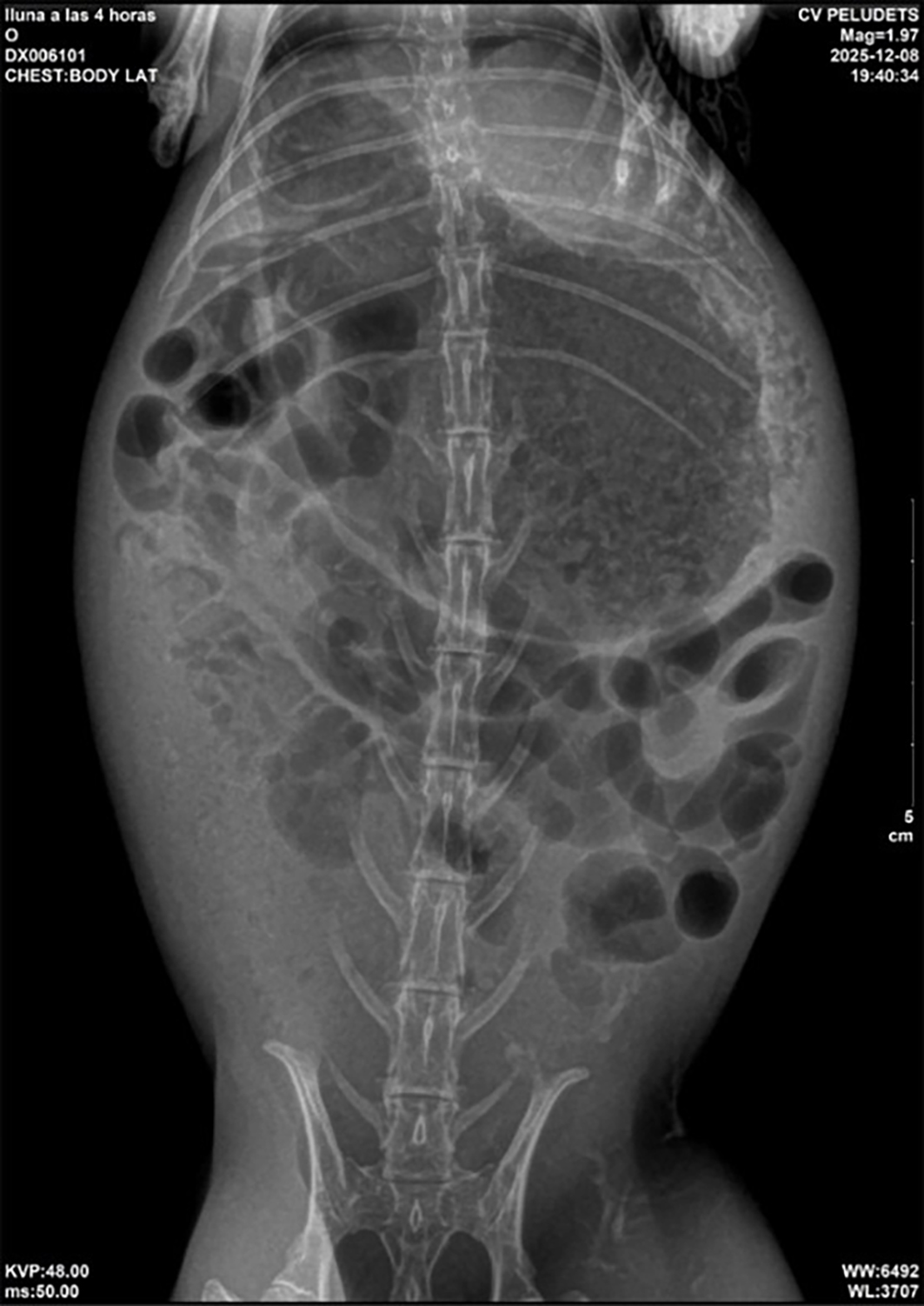 Radiografía ventrodorsal de abdomen a las 4 horas.
