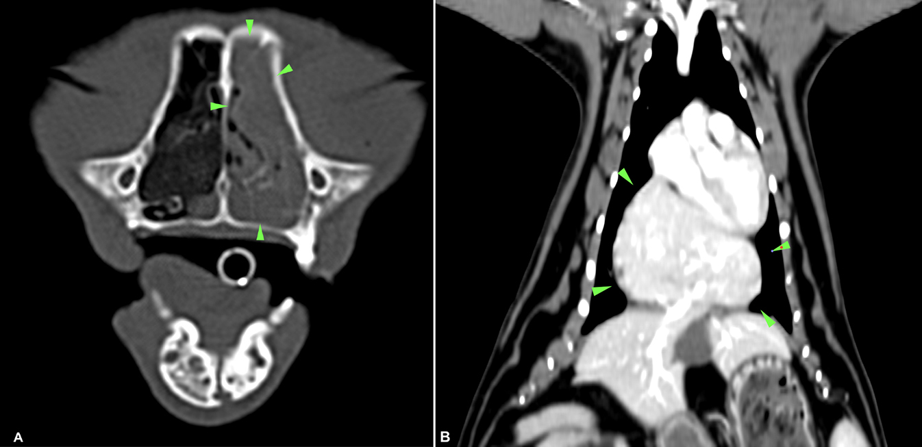 (<b>A</b>) CT Nasal. Material avascular en cavidad nasal (puntas de flecha verdes). (<b>B</b>) CT Tórax. Herniación diafragmática (puntas de flecha verdes) de lóbulos hepáticos medial derecho, cuadrado y medial izquierdo.