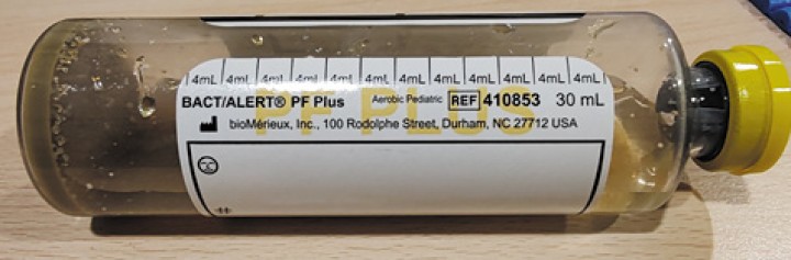 Medio líquido utilizado para realizar los hemocultivos.