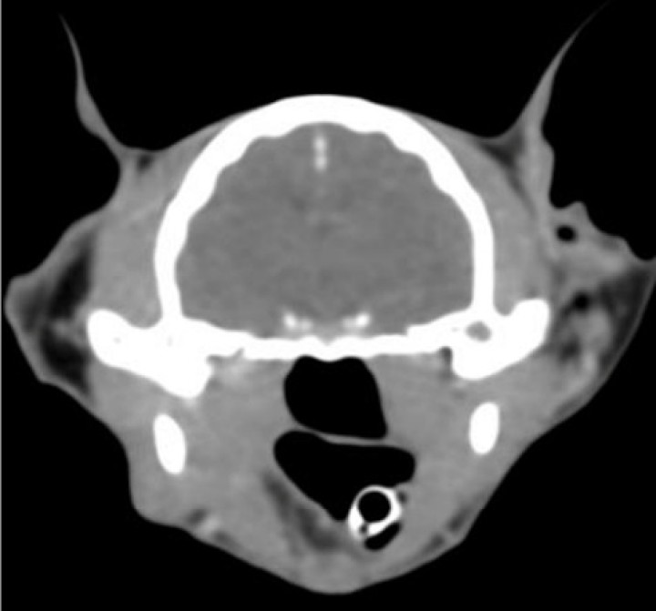 Imagen tomográfica transversa donde, a nivel intracraneal, no se evidencia ninguna lesión intra o extraaxial, no existe desplazamiento de la línea media, ni edema cerebral. La captación de contraste es normal y simétrica. Sin alteraciones meníngeas. Imagen cedida por el Hospital Bluecare.