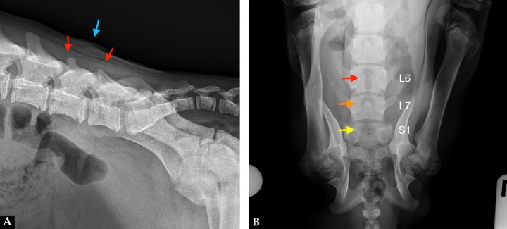 Mismas imágenes que la Figura 1. (A) Radiografía lateral derecha de la región lumbosacra. La apófisis espinosa de la sexta como de la séptima vértebra lumbar tienen una altura reducida (flechas rojas). Disminución de la radiopacidad a nivel de las apófisis articulares entre L6 y L7. El borde cutáneo dorsocaudal a L6 se observa irregular y el tejido blando subcutáneo presenta un aumento de su radiopacidad (flecha azul). (B) Radiografía dorsoventral de la región lumbosacra. Fémures posicionados en dirección craneolateral a la pared abdominal, cóndilos rotados medialmente y rótulas laterales a la diáfisis distal. Sobre el cuerpo y en la línea media de L6 se observa un área radiolúcida con forma de ojo de cerradura y no se identifica la apófisis espinosa (flecha roja). La apófisis espinosa de L7 es corta y redondeada (flecha naranja). En la línea media de la primera vértebra sacra (S1) se observa un área radiolúcida y no se visualiza la cresta medial sagital (flecha amarilla)