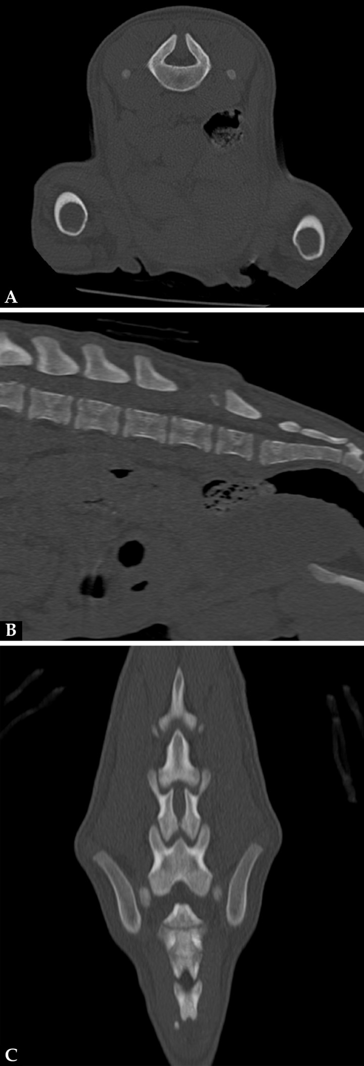 Imágenes de TC en ventana de hueso. (A) Plano transversal. (B) Reconstrucción en plano sagital. (C) Reconstrucción en plano dorsal. Hipoplasia de la apófisis espinosa de L6 sin fusión de las láminas dorsales dejando un espacio abierto que comunica el canal vertebral y el tejido blando lumbar caudodorsal a L6