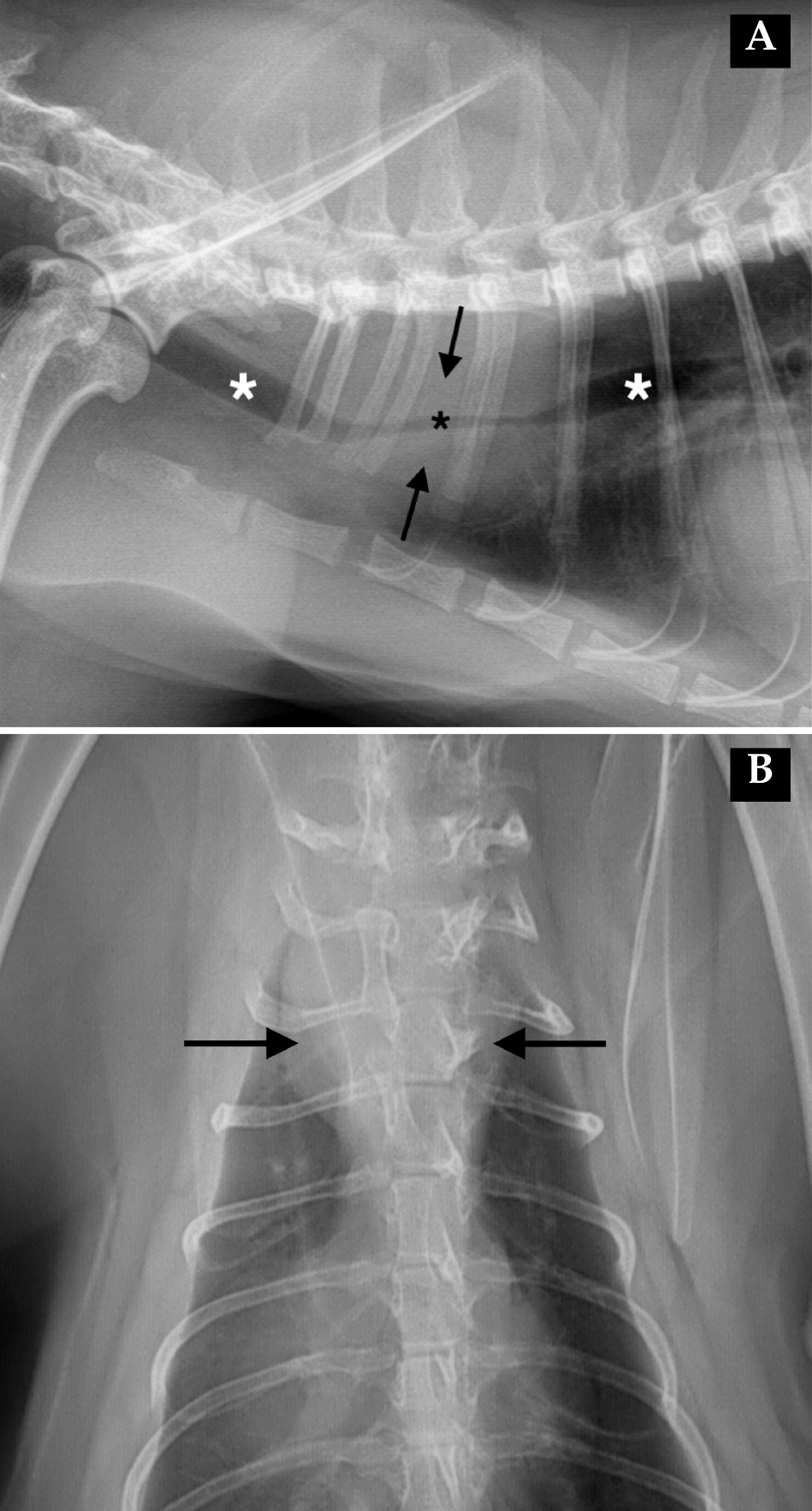 Imágenes ampliadas de las radiografías de la Figura 1. (A) Proyección lateral derecha. (B) Proyección dorsoventral. Se observa una masa de opacidad tejido blando-líquido (flechas negras) afectando a la porción torácica de la tráquea. La masa se extiende a la altura del segmento vertebral T1-T3, causando una reducción significativa de la luz traqueal (asterisco negro) en comparación con el diámetro normal de la tráquea (asteriscos blancos).