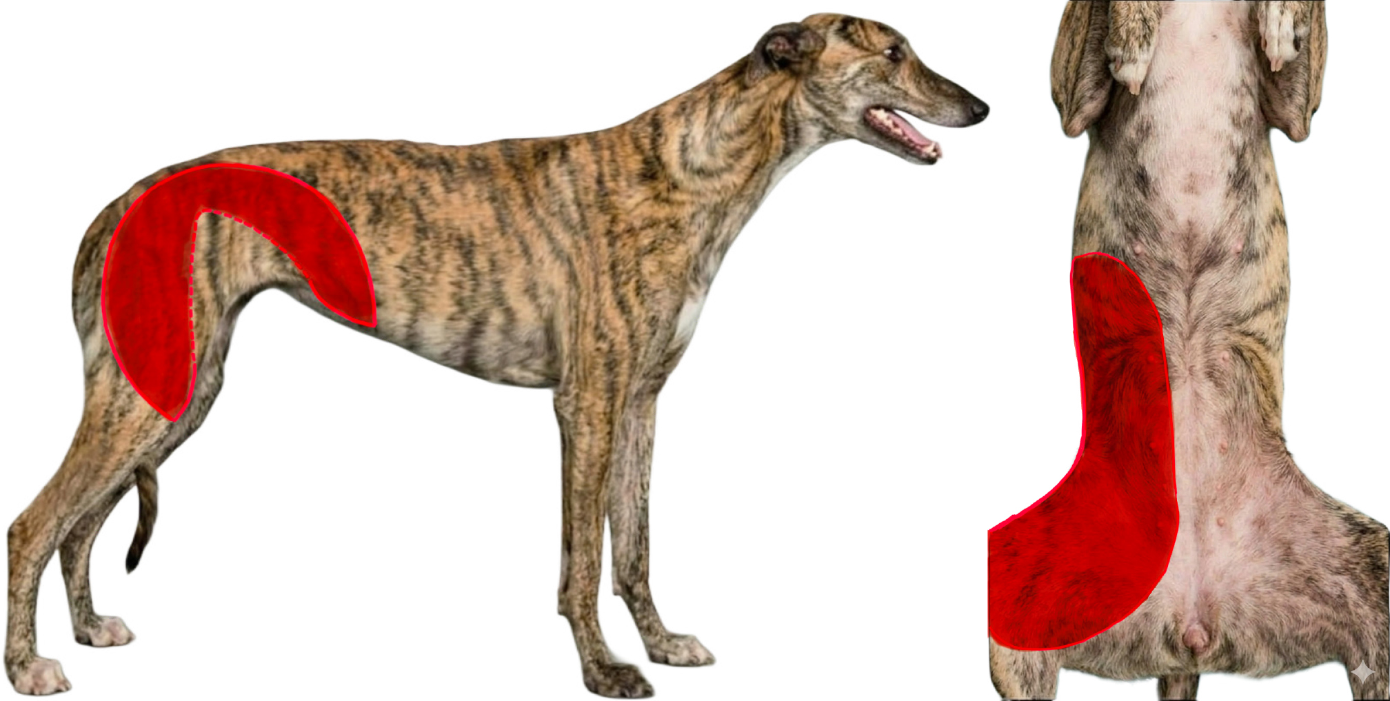 <b>Indicaciones</b>. Su elevación y transposición permiten la reconstrucción de defectos: <b>1</b>) desde la región media del muslo hasta la tibia proximal; <b>2</b>) desde la región del muslo proximal y la región de la cadera hasta el abdomen ventral. Los colgajos bilaterales del pliegue inguinal pueden utilizarse para reconstruir grandes defectos del abdomen ventral.