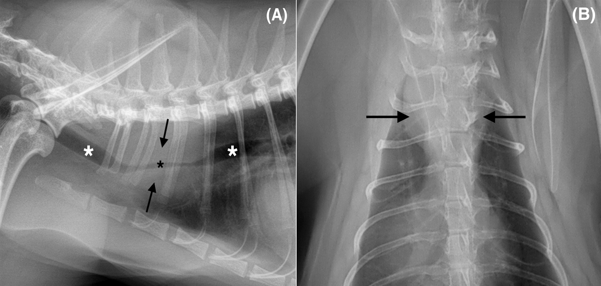 Imágenes ampliadas de las radiografías de la Figura 1. (A) Proyección lateral derecha. (B) Proyección dorsoventral. Se observa una masa de opacidad tejido blando-líquido (flechas negras) afectando a la porción torácica de la tráquea. La masa se extiende a la altura del segmento vertebral T1-T3, causando una reducción significativa de la luz traqueal (asterisco negro) en comparación con el diámetro normal de la tráquea (asteriscos blancos).