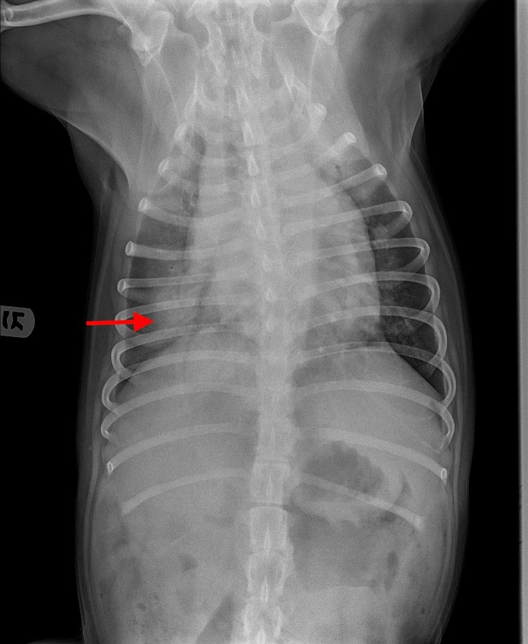 Radiografía dorsoventral de tórax de un perro con fallo cardiaco congestivo secundario a una cardiomiopatía dilatada. Se observa cardiomegalia y patrón alveolar en el lóbulo caudal derecho compatible con edema pulmonar de origen cardiogénico (flecha roja).